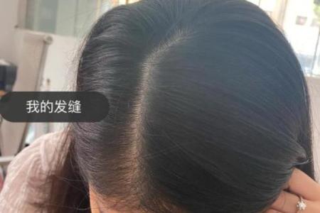 头发后面尖尖的暗藏玄机，你的命运已经注定吗？